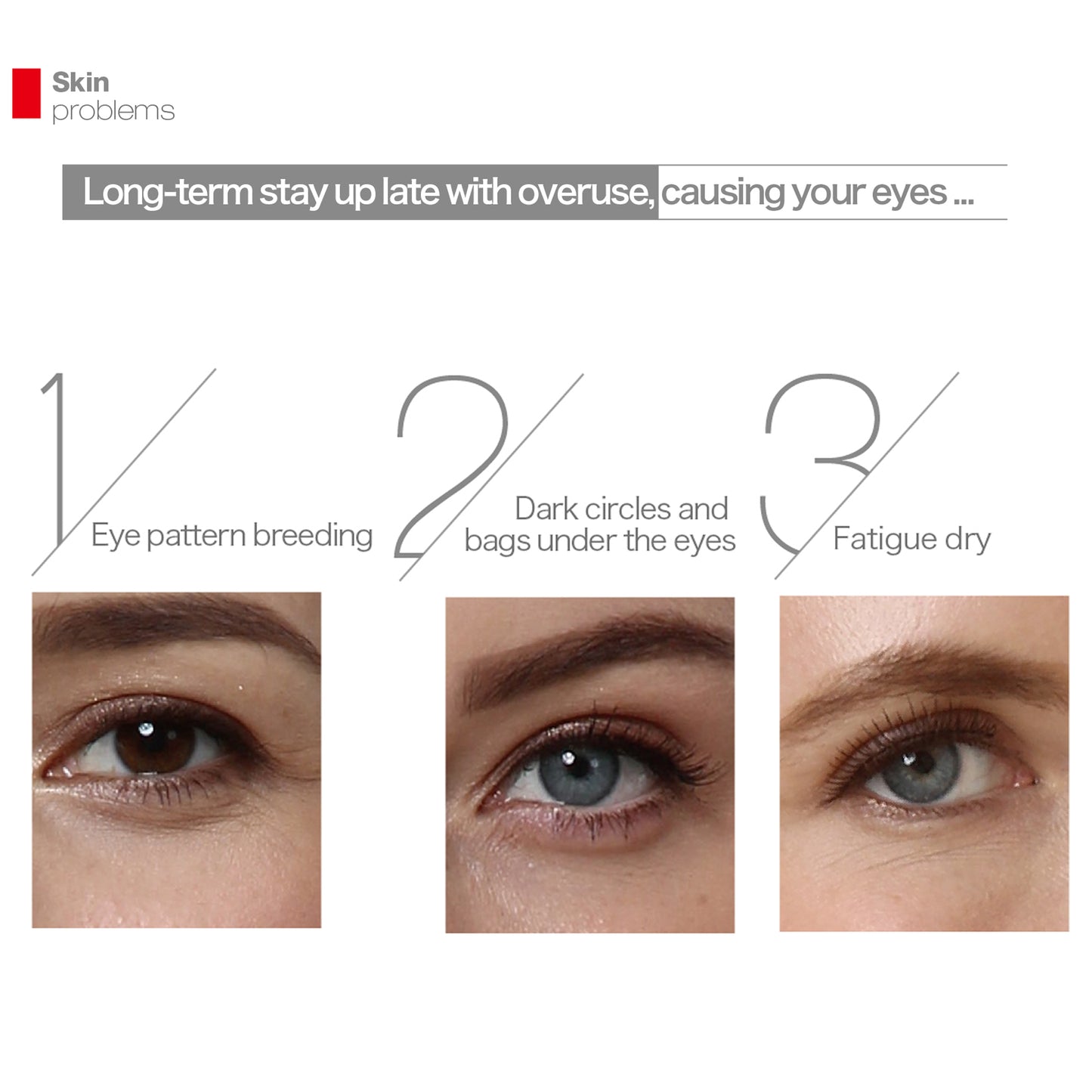 【Goodbye Black Circles🐼】Lifetrons EM-100 Ionic Eye Massager